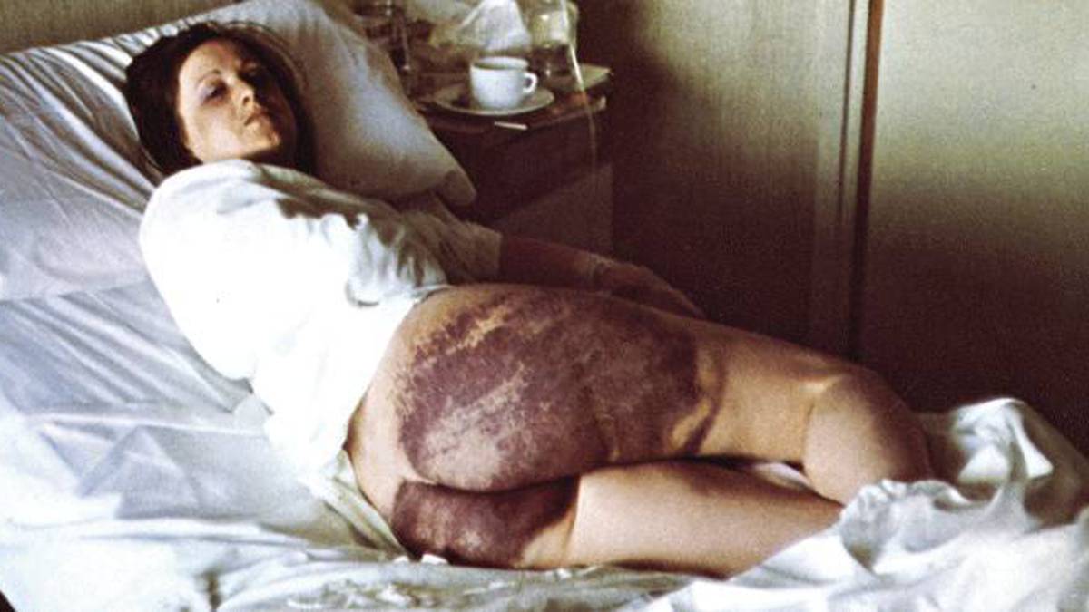 Amparo Arangoa leitzarra ere torturaren biktima izan zela aitortu du Nafarroako Gobernuak