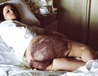 Amparo Arangoa leitzarra ere torturaren biktima izan zela aitortu du Nafarroako Gobernuak